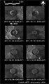 陸域観測技術衛星「だいち」(ALOS)搭載Lバンド合成開口レーダ(PALSAR；パルサー)による新燃岳周辺の拡大図、1段め左:2011年1月18日(噴火前)、1段め右:2011年1月27日、2段め左:2011年1月29日、2段め右:2011年1月30日、3段め左:2011年2月1日、3段め右:2011年2月3日、4段め左:2011年2月4日、4段め右:2011年2月6日の観測結果